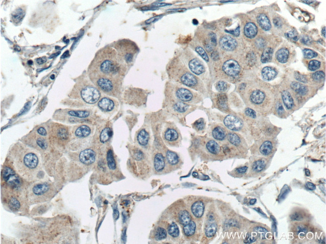 GALK1 Antibody in Immunohistochemistry (Paraffin) (IHC (P))