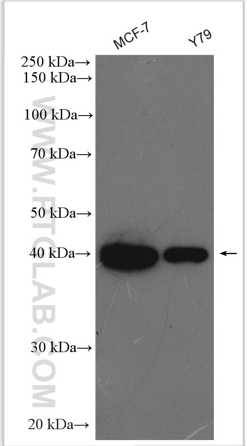 GALK1 Antibody in Western Blot (WB)