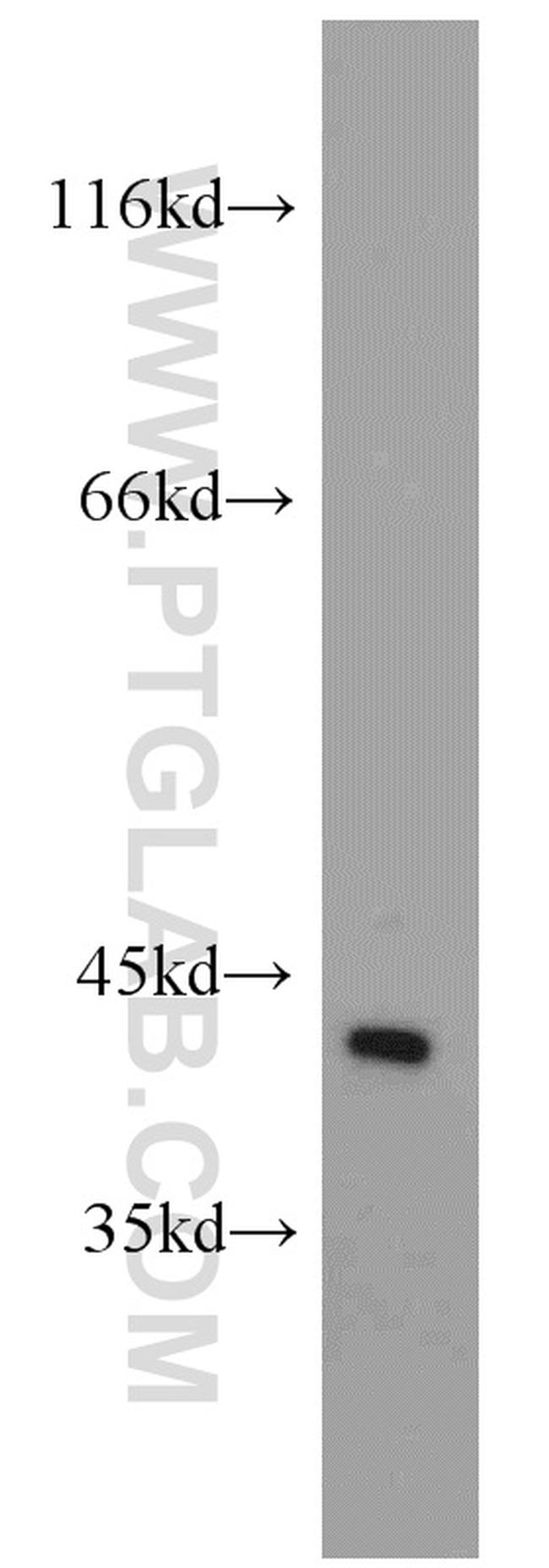 GALK1 Antibody in Western Blot (WB)