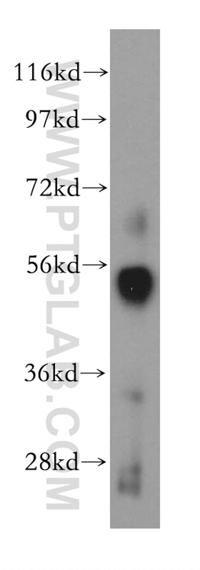 SC65 Antibody in Western Blot (WB)