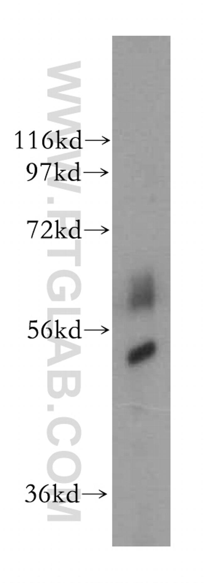 SC65 Antibody in Western Blot (WB)