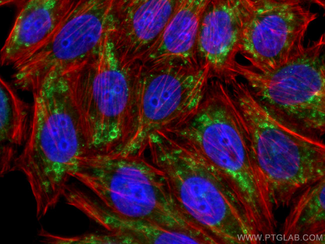 ADRP/Perilipin 2 Antibody in Immunocytochemistry (ICC/IF)