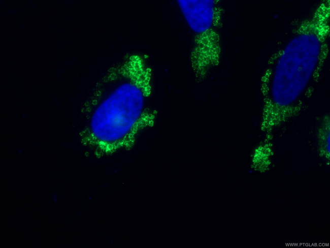 ADRP/Perilipin 2 Antibody in Immunocytochemistry (ICC/IF)