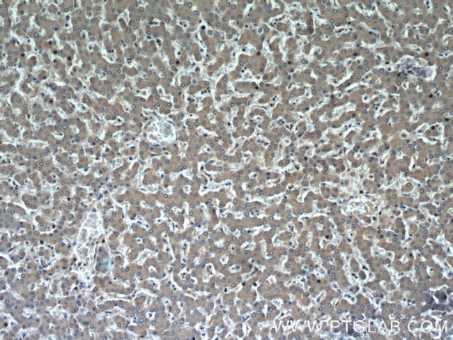 ADRP/Perilipin 2 Antibody in Immunohistochemistry (Paraffin) (IHC (P))