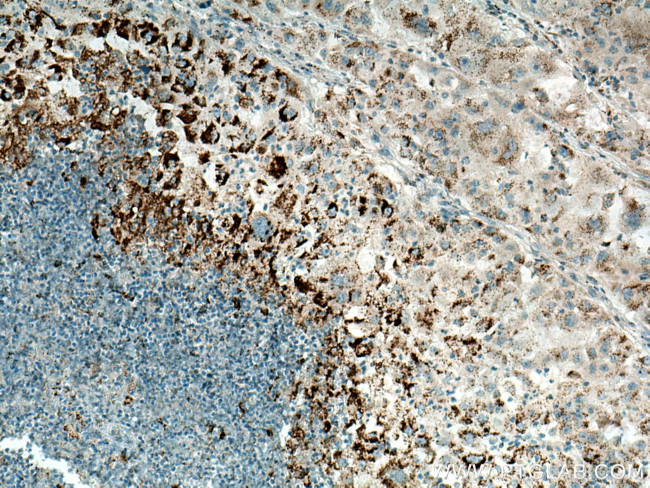 ADRP/Perilipin 2 Antibody in Immunohistochemistry (Paraffin) (IHC (P))