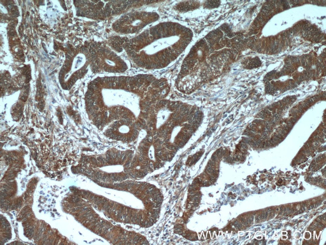 ADRP/Perilipin 2 Antibody in Immunohistochemistry (Paraffin) (IHC (P))