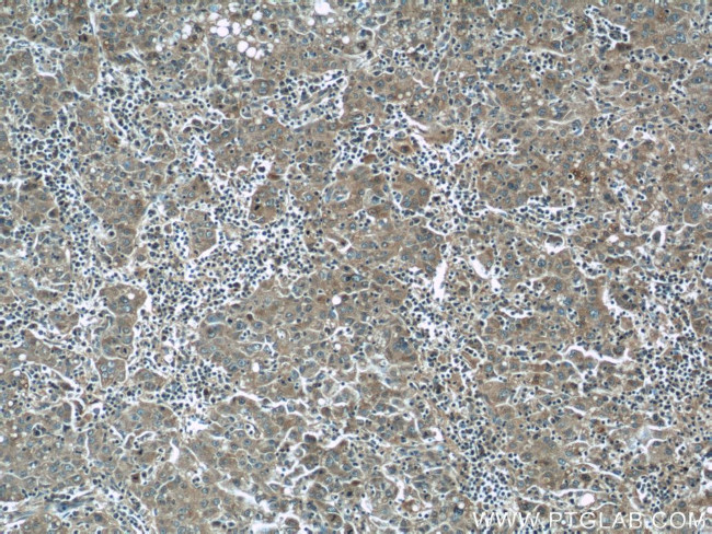 ADRP/Perilipin 2 Antibody in Immunohistochemistry (Paraffin) (IHC (P))