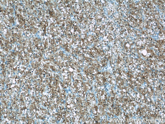 ADRP/Perilipin 2 Antibody in Immunohistochemistry (Paraffin) (IHC (P))