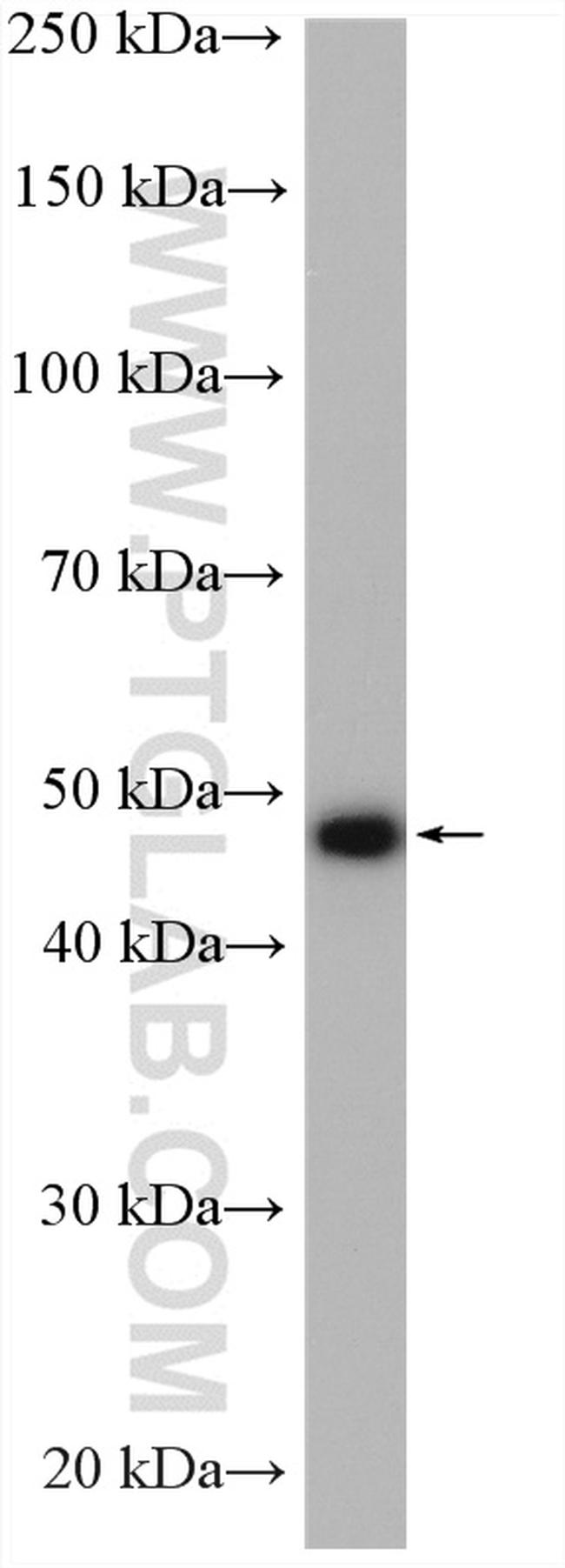 ADRP/Perilipin 2 Antibody in Western Blot (WB)