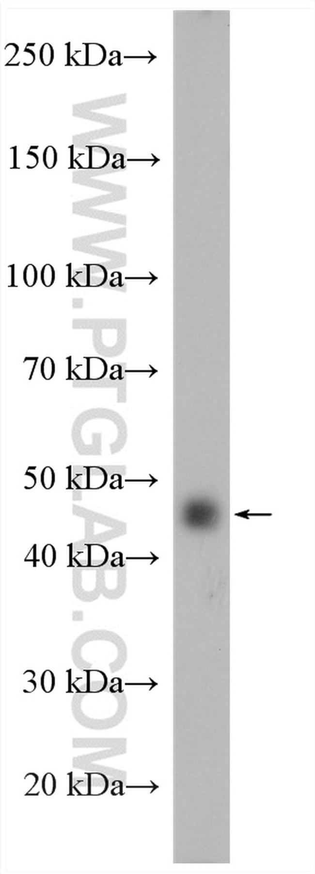 ADRP/Perilipin 2 Antibody in Western Blot (WB)