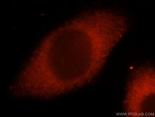 CARS Antibody in Immunocytochemistry (ICC/IF)