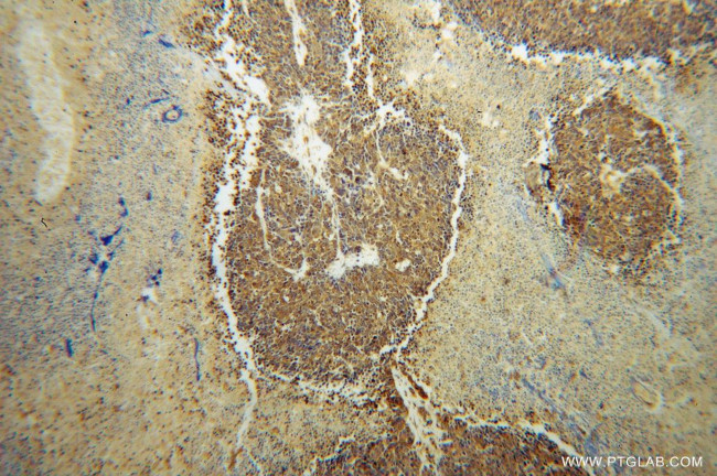 CARS Antibody in Immunohistochemistry (Paraffin) (IHC (P))