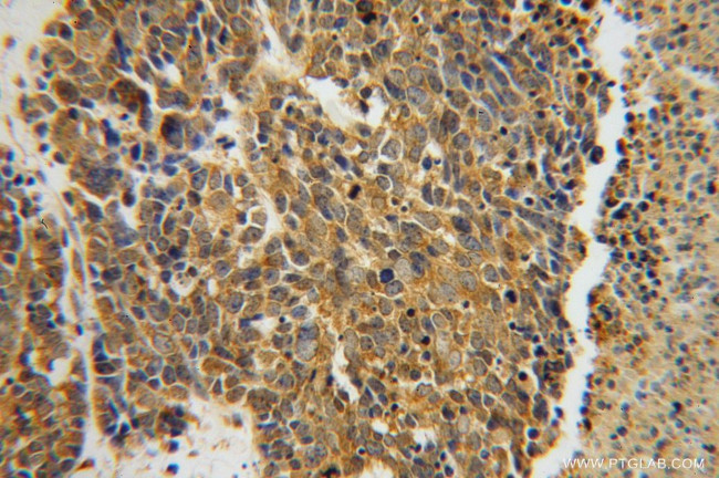 CARS Antibody in Immunohistochemistry (Paraffin) (IHC (P))