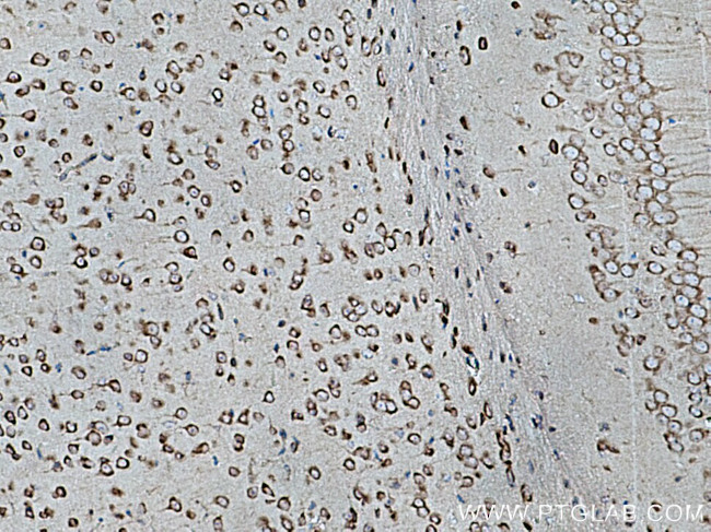 CARS Antibody in Immunohistochemistry (Paraffin) (IHC (P))