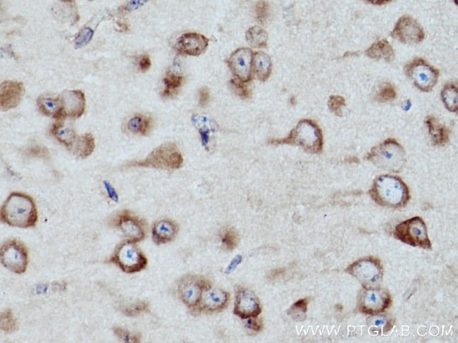 CARS Antibody in Immunohistochemistry (Paraffin) (IHC (P))