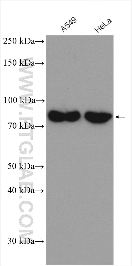 CARS Antibody in Western Blot (WB)