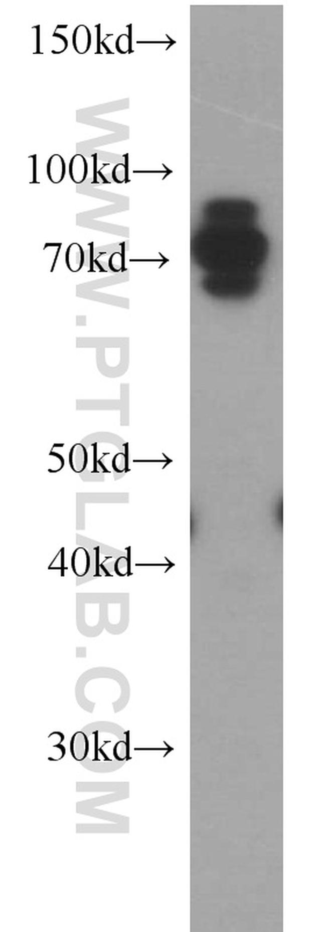 CARS Antibody in Western Blot (WB)