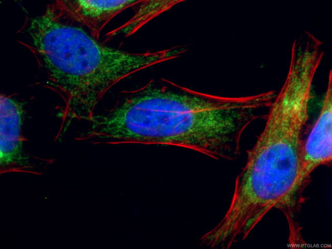 NDUFV2 Antibody in Immunocytochemistry (ICC/IF)