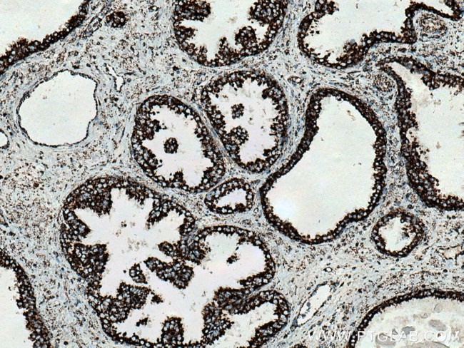 NDUFV2 Antibody in Immunohistochemistry (Paraffin) (IHC (P))