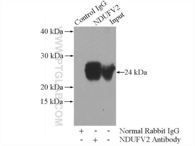 NDUFV2 Antibody in Immunoprecipitation (IP)