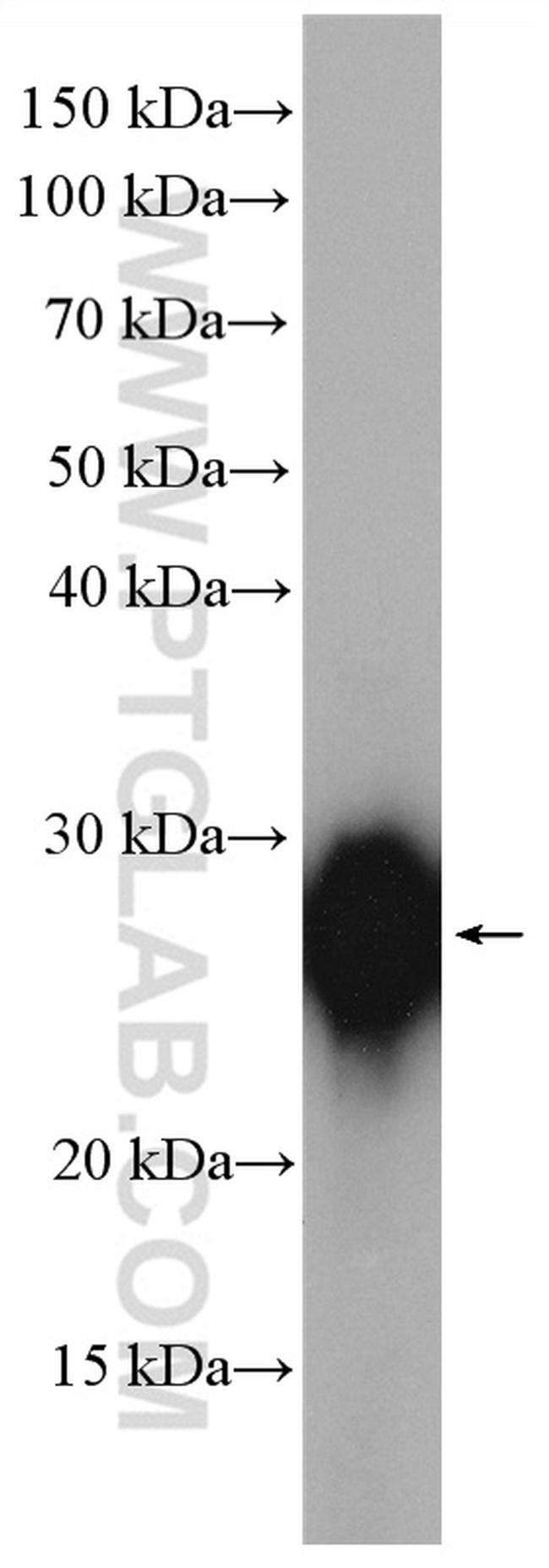 NDUFV2 Antibody in Western Blot (WB)