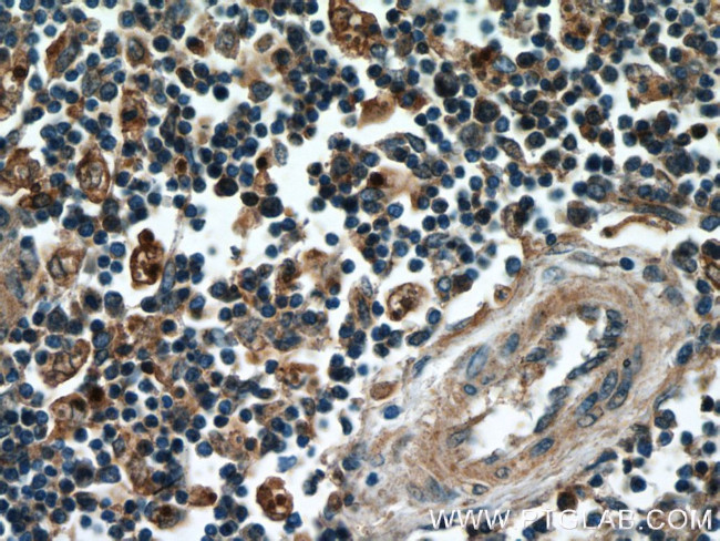 GBP1 Antibody in Immunohistochemistry (Paraffin) (IHC (P))