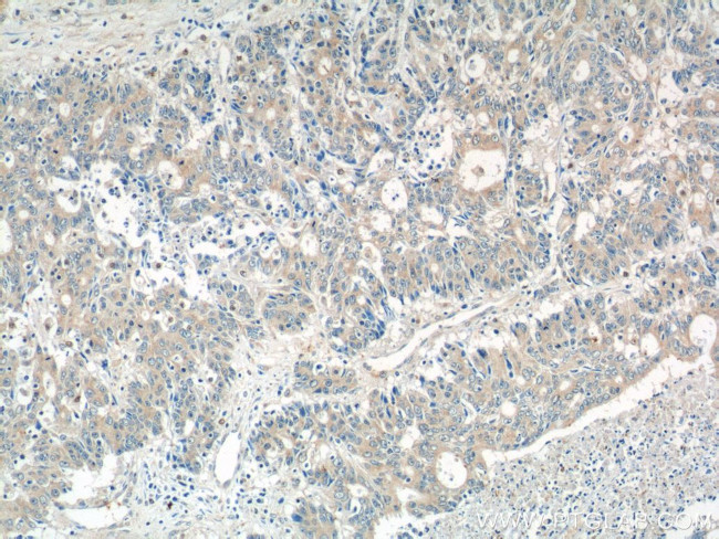 ADAMTSL4 Antibody in Immunohistochemistry (Paraffin) (IHC (P))