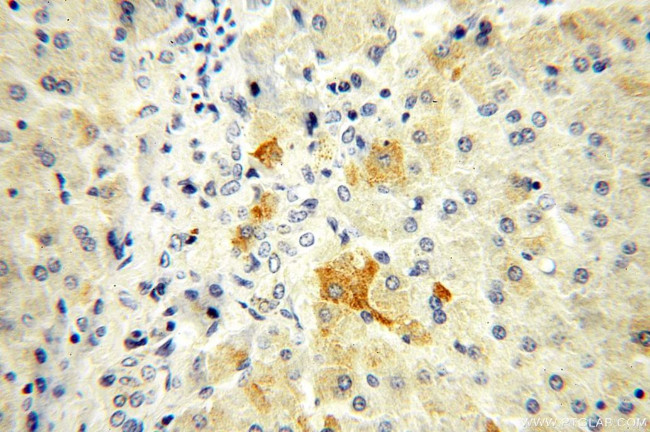 ADAMTSL4 Antibody in Immunohistochemistry (Paraffin) (IHC (P))