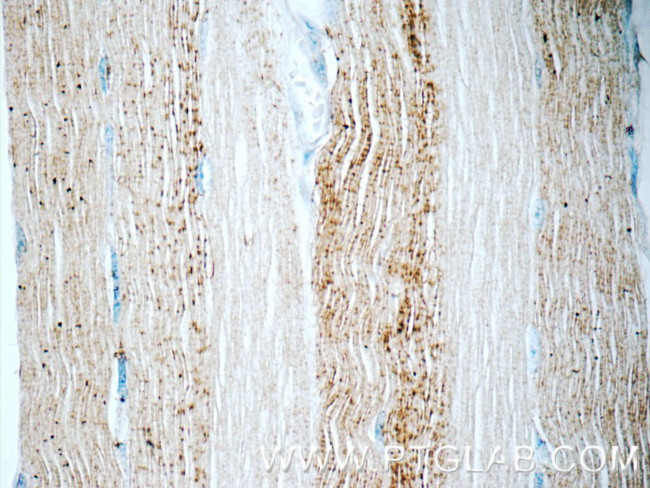 ADAMTSL4 Antibody in Immunohistochemistry (Paraffin) (IHC (P))