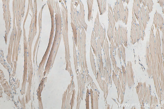 ADAMTSL4 Antibody in Immunohistochemistry (Paraffin) (IHC (P))