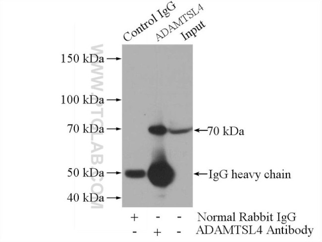 ADAMTSL4 Antibody in Immunoprecipitation (IP)