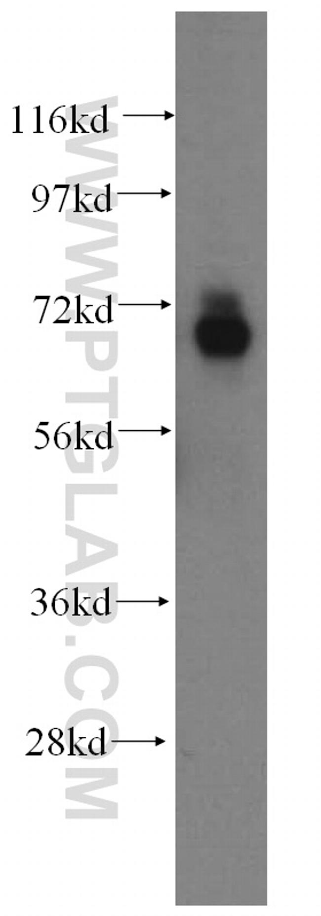 ADAMTSL4 Antibody in Western Blot (WB)