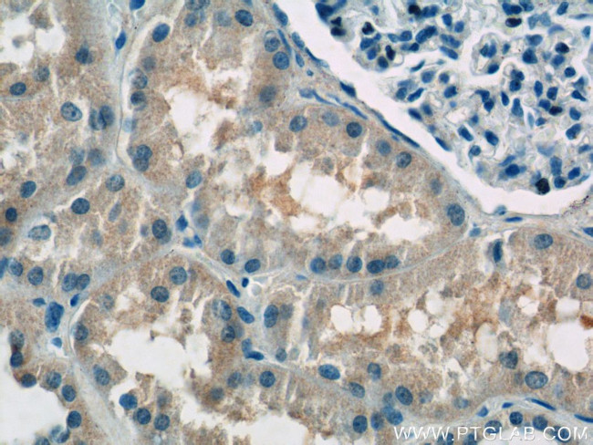 ATP6AP1 Antibody in Immunohistochemistry (Paraffin) (IHC (P))