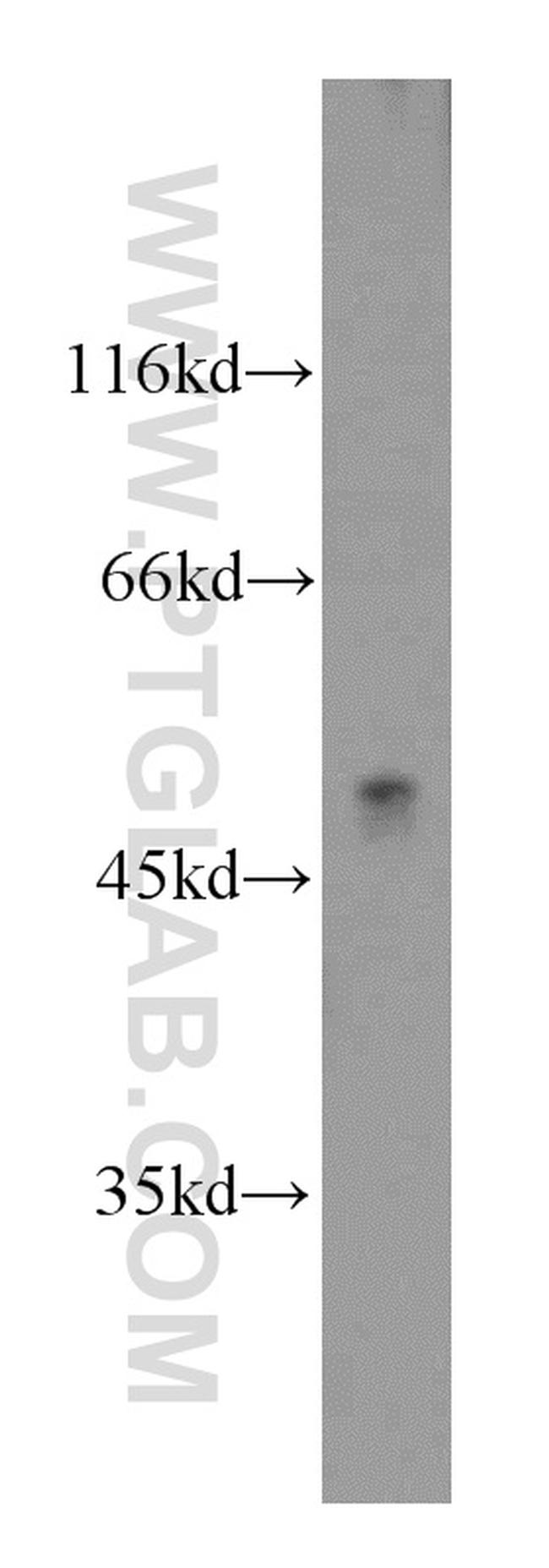 ATP6AP1 Antibody in Western Blot (WB)