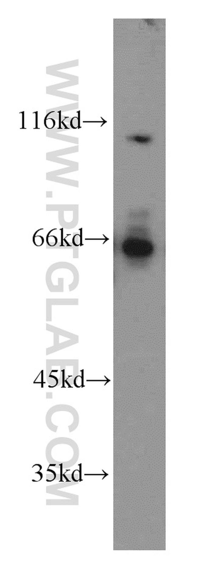 ATP6AP1 Antibody in Western Blot (WB)