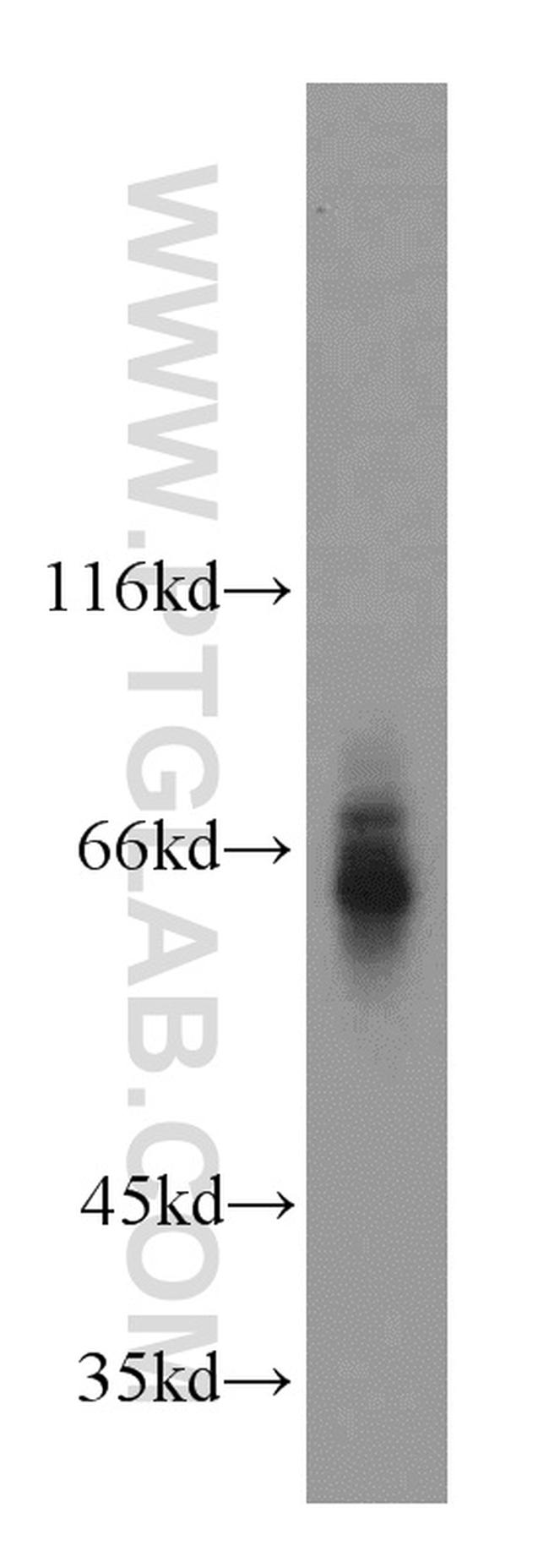 ATP6AP1 Antibody in Western Blot (WB)