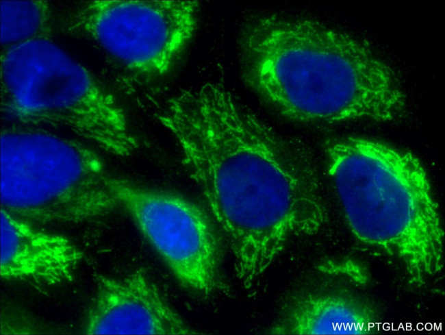 ALDH2 Antibody in Immunocytochemistry (ICC/IF)