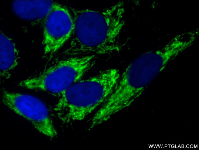 ALDH2 Antibody in Immunocytochemistry (ICC/IF)