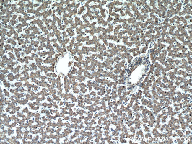 ALDH2 Antibody in Immunohistochemistry (Paraffin) (IHC (P))