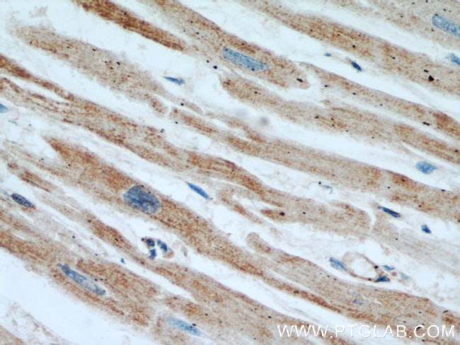 ALDH2 Antibody in Immunohistochemistry (Paraffin) (IHC (P))