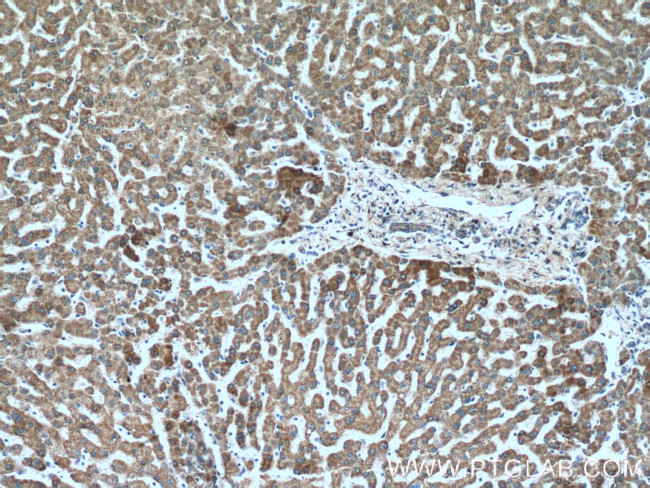 ALDH2 Antibody in Immunohistochemistry (Paraffin) (IHC (P))