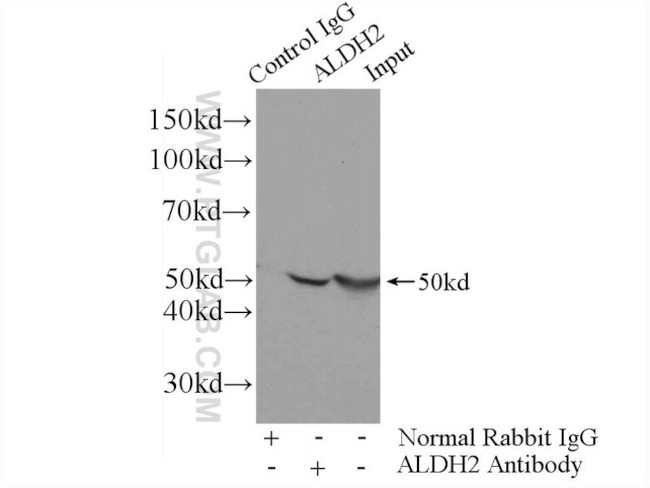 ALDH2 Antibody in Immunoprecipitation (IP)