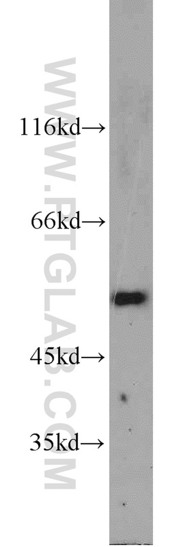 ALDH2 Antibody in Western Blot (WB)