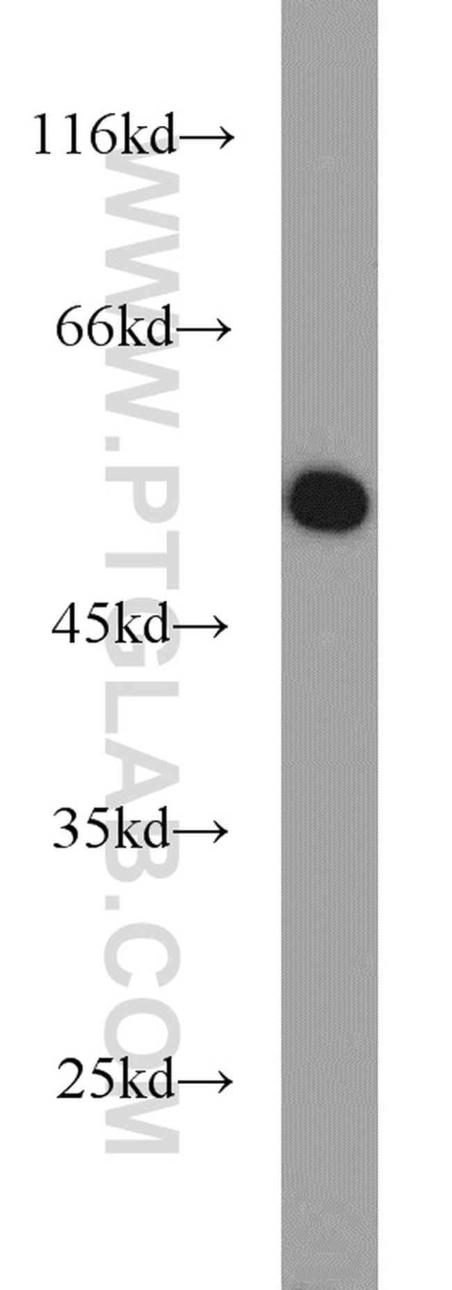 ALDH2 Antibody in Western Blot (WB)