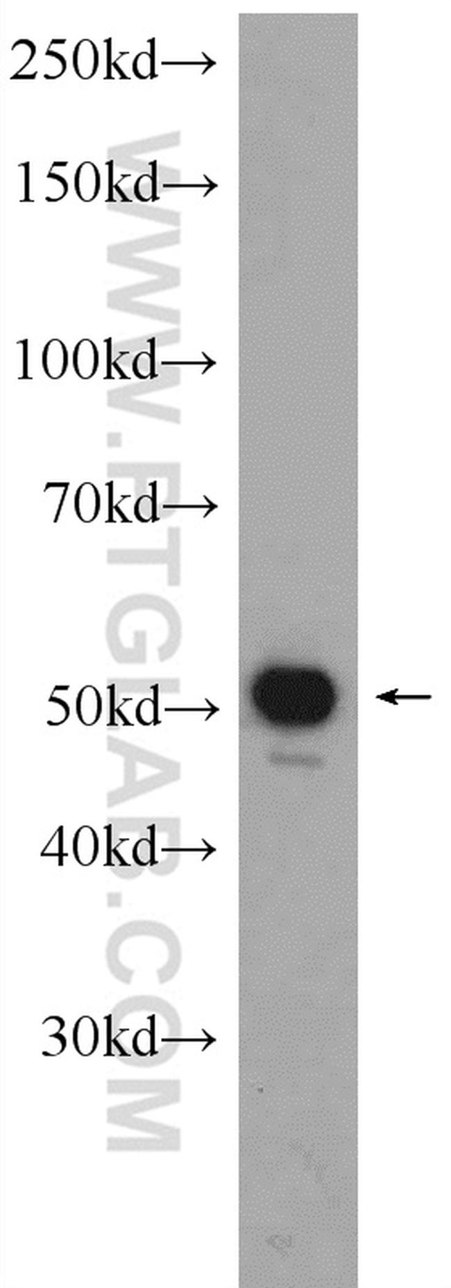 ALDH2 Antibody in Western Blot (WB)