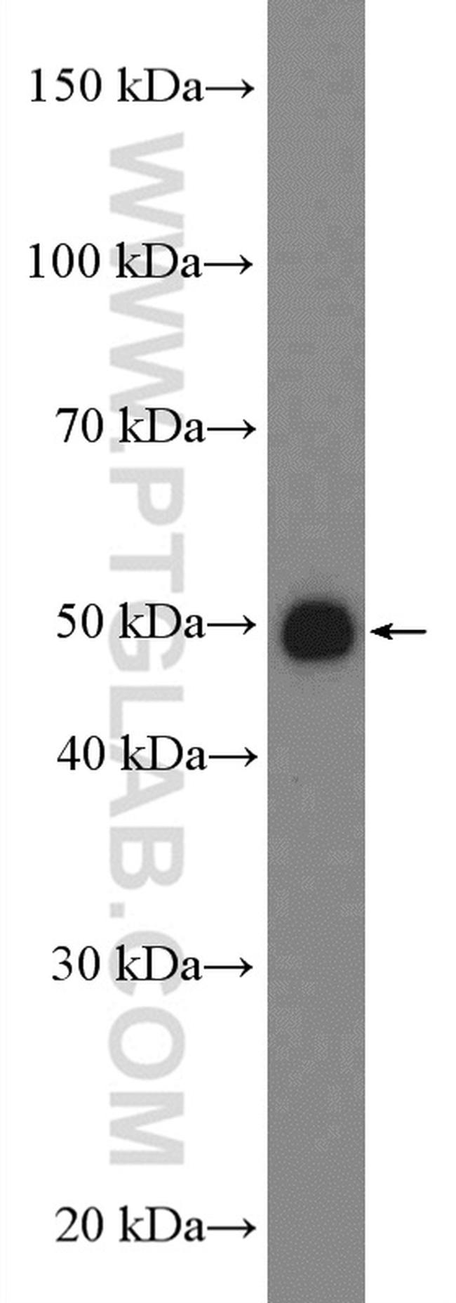 ALDH2 Antibody in Western Blot (WB)