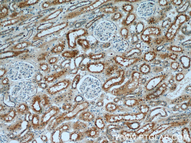 STXBP2 Antibody in Immunohistochemistry (Paraffin) (IHC (P))