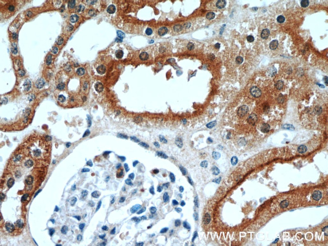 STXBP2 Antibody in Immunohistochemistry (Paraffin) (IHC (P))