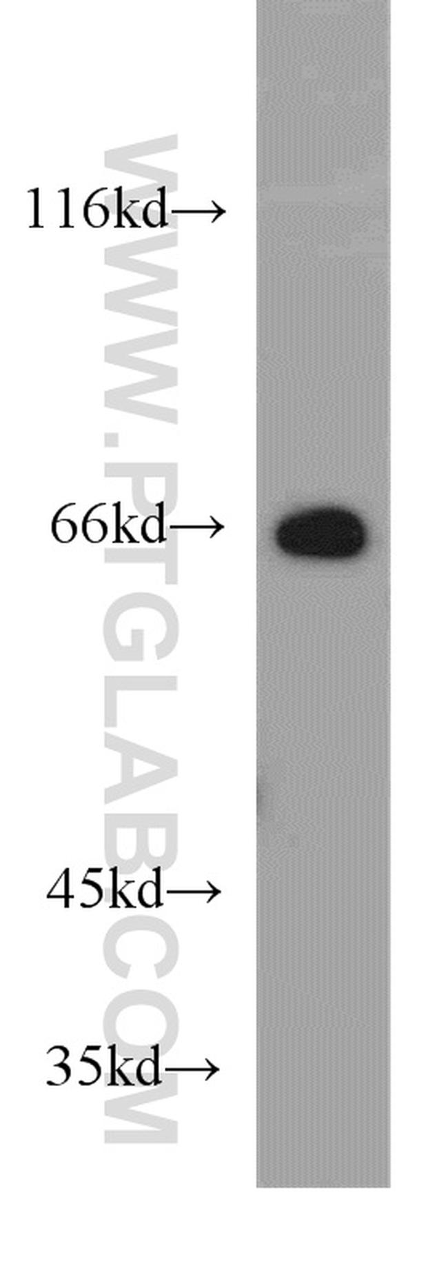 STXBP2 Antibody in Western Blot (WB)