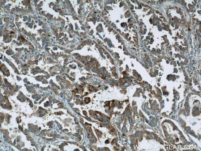 STXBP2 Antibody in Immunohistochemistry (Paraffin) (IHC (P))